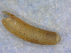 Caecum