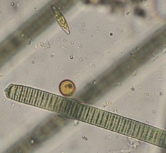 Coscinodiscophycidae