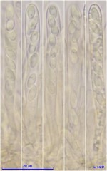 Lachnellula calyciformis