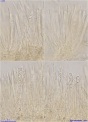 Lachnellula calyciformis