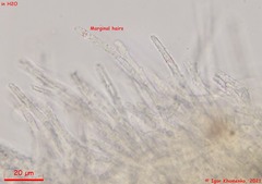 Lachnellula calyciformis