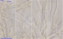 Lachnellula calyciformis