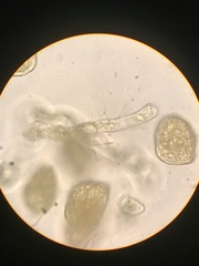 Paraphymatoceros pearsonii