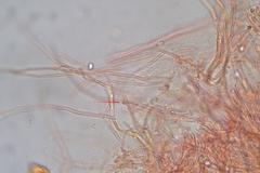 Postia pelliculosa