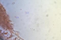 Postia pelliculosa