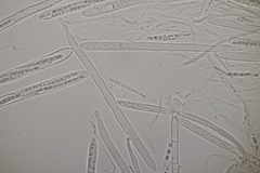 Godronia ribis