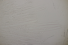 Godronia ribis