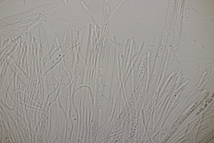 Godronia ribis