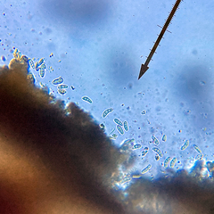 Cresponea chloroconia