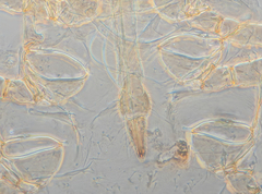 Acyrthosiphon lactucae