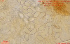 Lasiobolus intermedius