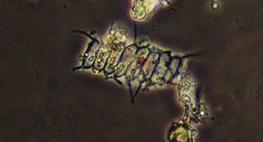 Scenedesmus