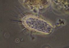 Euglypha acanthophora
