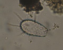 Euglypha acanthophora