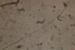 Oscillatoria redekei