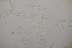 Peronosporales