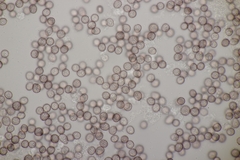 Microbotryum lychnidis-dioicae