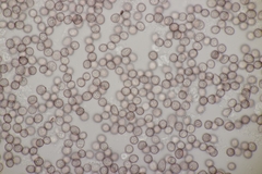 Microbotryum lychnidis-dioicae