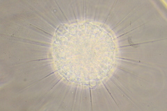 Actinosphaerium