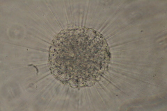 Actinosphaerium