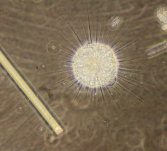 Actinosphaerium