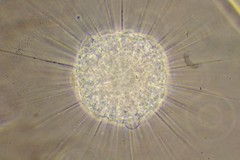 Actinosphaerium