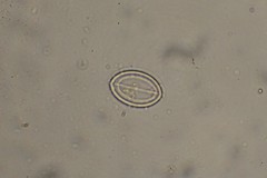 Cocconeis placentula