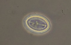 Cocconeis placentula