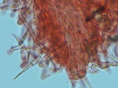 Hyphodontia arguta