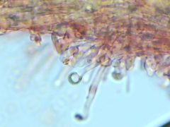 Hyphodontia arguta