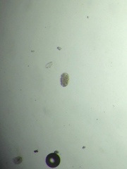Ancylostoma