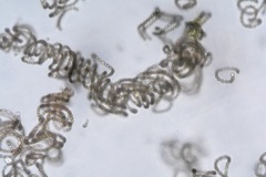 Dolichospermum spiroides