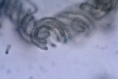 Dolichospermum spiroides