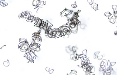 Dolichospermum spiroides