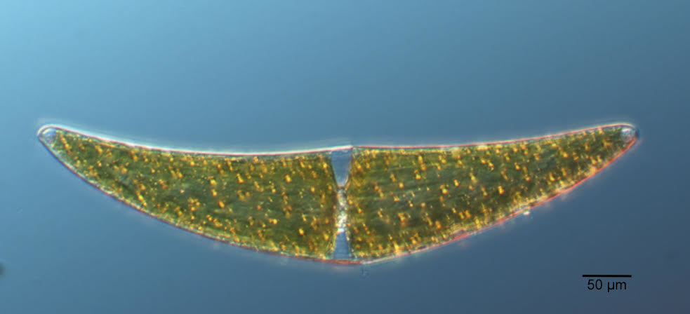 Closterium ehrenbergii