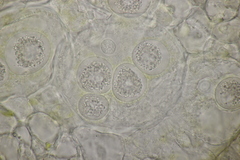 Synchytrium mercurialis