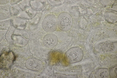 Synchytrium mercurialis