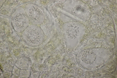 Synchytrium mercurialis