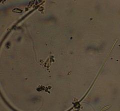 Oscillatoria redekei