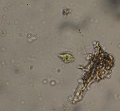 Scenedesmus