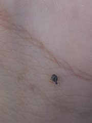 Aphididae