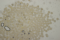 Puccinia albescens