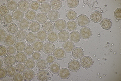 Puccinia albescens