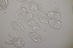 Puccinia albescens
