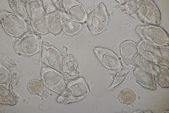 Puccinia albescens