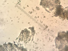 Chaenothecopsis ochroleuca