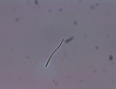Bacidia heterochroa