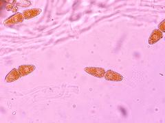 Gymnosporangium juniperi