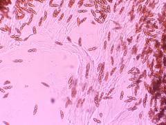 Gymnosporangium juniperi