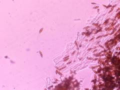 Gymnosporangium juniperi